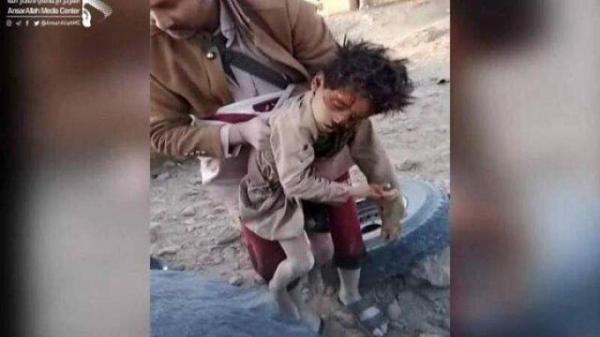 گزارشی از تلفات انسانی و خسارتهای مادی 2100 روز جنایت سعودی گزارشی از تلفات انسانی و خسارتهای مادی 2100 روز جنایت سعودی در یمن
